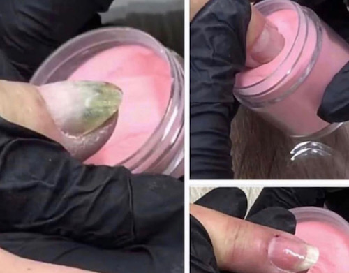 This is a picture of two infected nails being dipped in pigment for dip powdered nails.